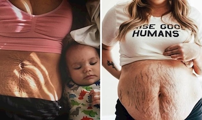 20 žena koje su skupile hrabrost i na internetu pokazale kako im tijela izgledaju nakon trudnoće