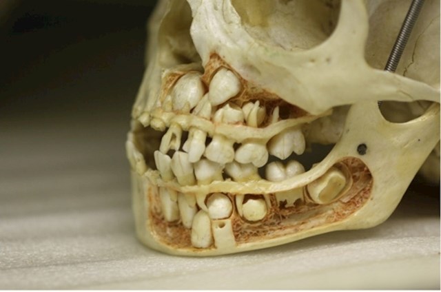 Ovako izgleda lubanja djeteta prije nego što izgubi mliječne zube