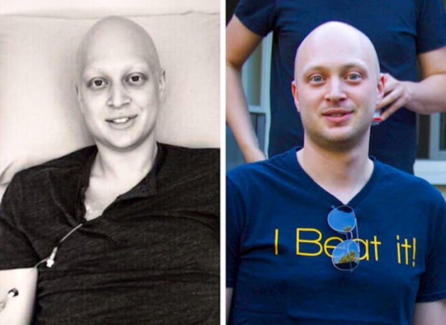 Muškarac dok je imao rak i 5 godina nakon što ga je pobijedio