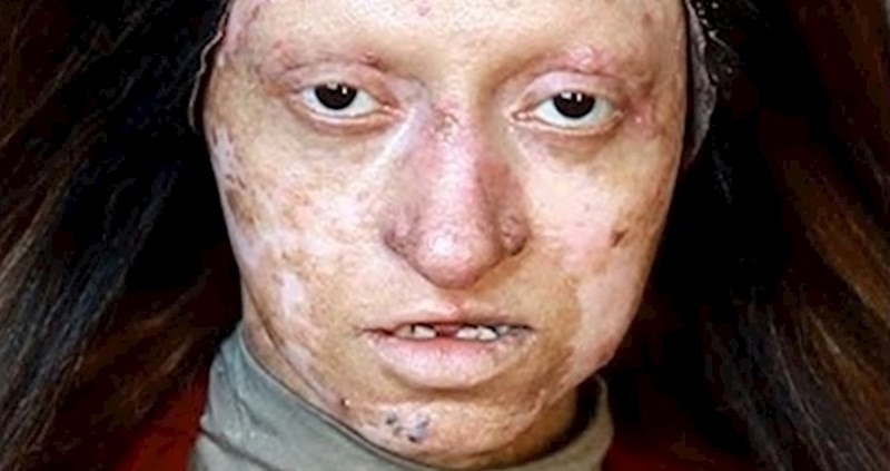 Nevjerojatna moć šminke: Ima kožnu bolest, nećete vjerovati kako je izgledala na kraju videa