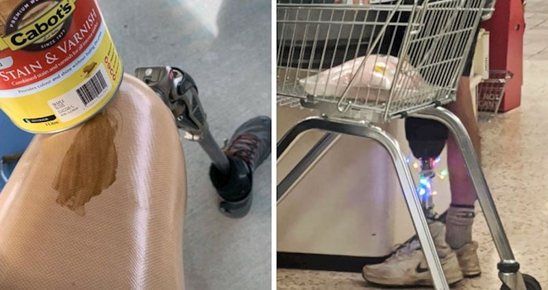 Bili su bolesni i ostali bez dijelova tijela, ali ne i bez smisla za humor