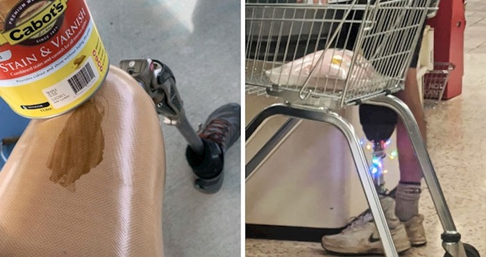 Bili su bolesni i ostali bez dijelova tijela, ali ne i bez smisla za humor