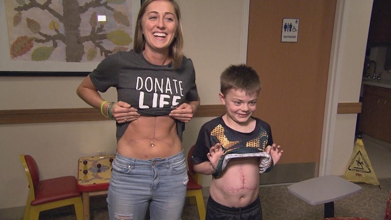 VIDEO Medicinska sestra i dječak imaju ožiljke na istom mjestu, razlog je zadivio američku javnost