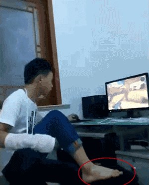 Čudan, ali nevjerojatan talent: Dječak je slomio ruku, no to ga nije spriječilo da nastavi igrati igrice