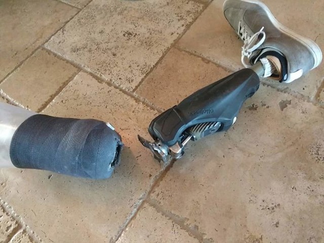 "Moj tetak je danas slomio nogu. Kaže da uopće nije boljelo."