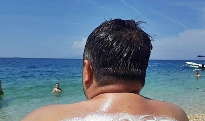 Žena je muža "zaštitila od jakog sunca", nije imao pojma što mu piše na leđima