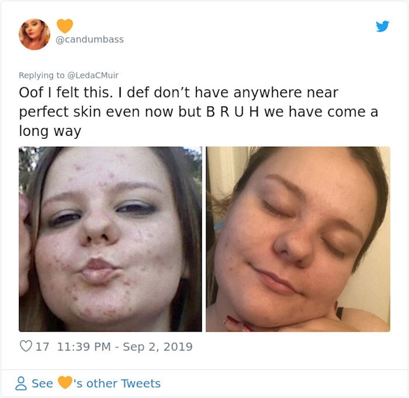 Inspirirani njenim uspjehom, i druge djevojke su počele objavljivati fotke: