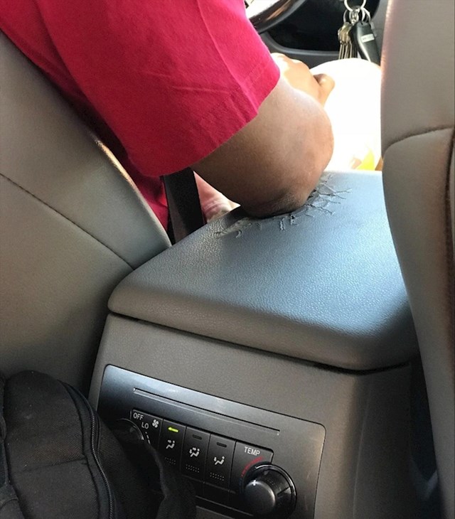 Uber vozač stalno drži lakat na istom mjestu pa mu se napravilo udubljenje...