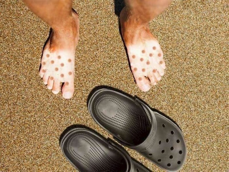 Ljeto nije baš dobro vrijeme za nošenje kroksica.