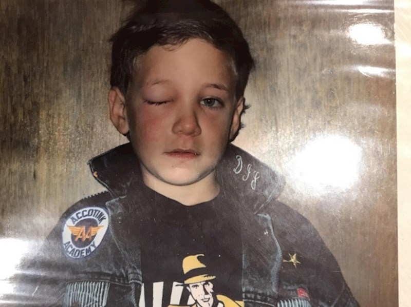 "Tata me slikao nakon što me moja prva djevojka opalila po oku."