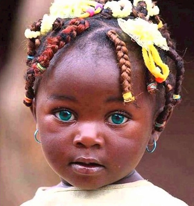 Afrička djevojčica s nevjerojatnom bojom očiju