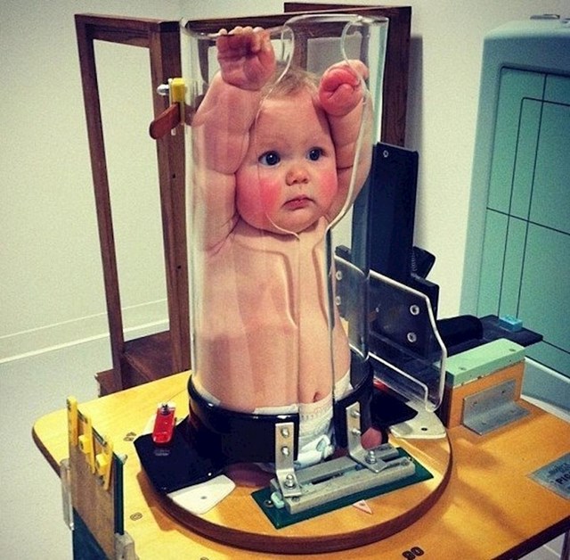 Ovako se bebama rade rendgenske slike. Na ovaj način se ne mogu cijelo vrijeme pomicati.