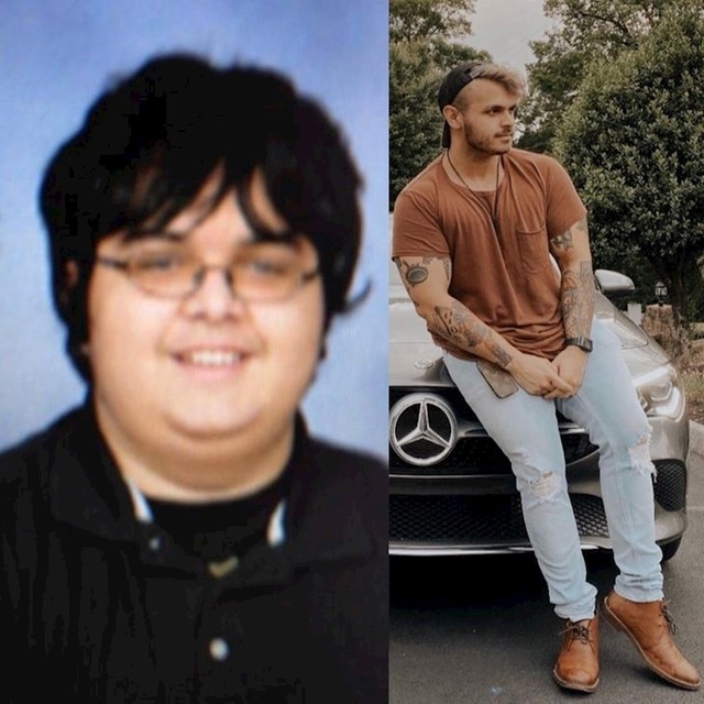 "S 13 godina sam izgledao kao Peter Griffin, evo kako danas izgledam."