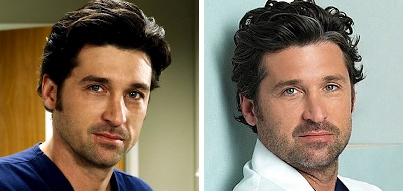 I sijeda kosa postaje sve uočljivija.