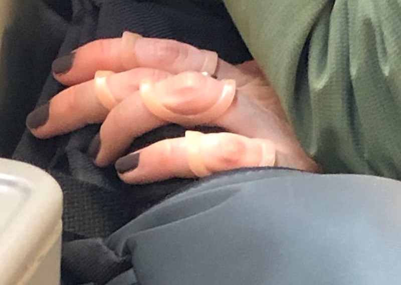 Ovi neobični krugovi služe za liječenje artritisa, lateralnih devijacija, zakrivljenih prstiju i sličnih stanja.