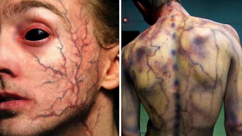 VIDEO 8 ljudi kojima su se nakon nesreća dogodile čudne stvari