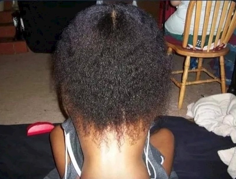 Postoje dvije vrste ljudi: Oni koji odmah shvate fotku i oni koji misle da je na njoj nečija glava i vrat.