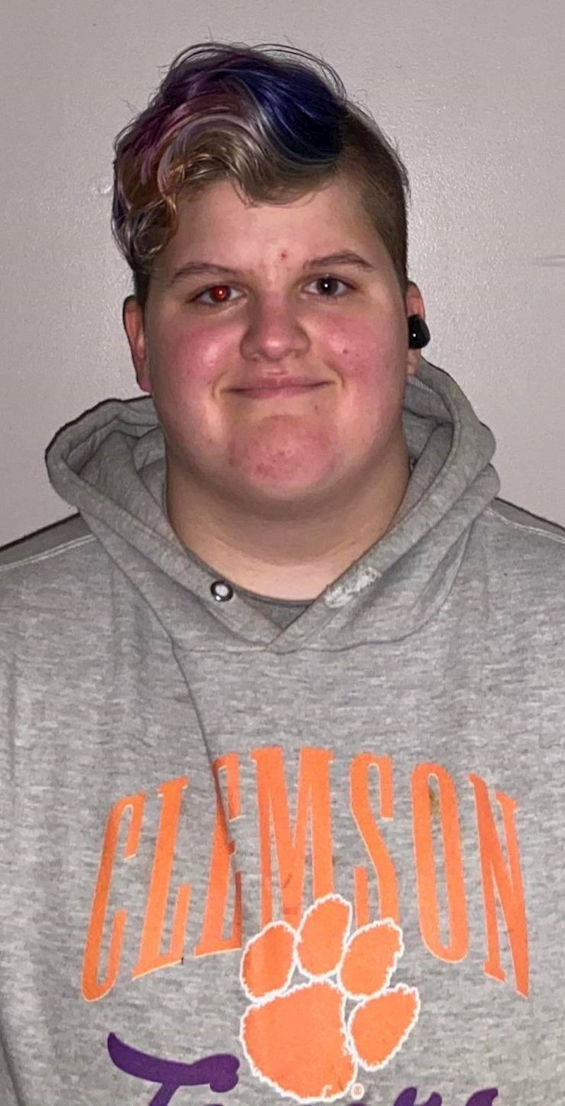 "Na svom lijevom oku jako loše vidim. Primijetila sam da čak ne bude ni crveno na slikama."