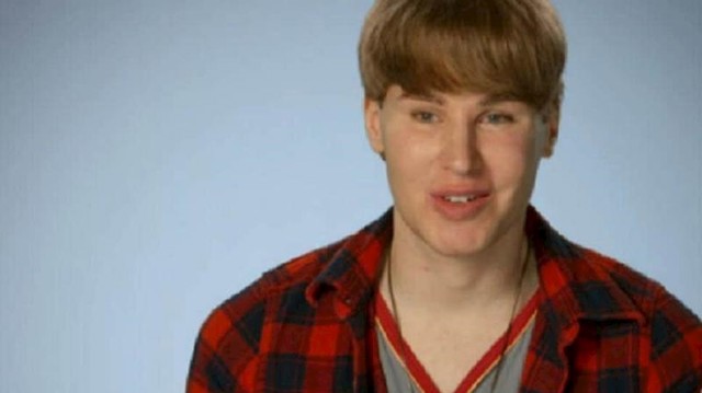 Tobias Strebel potrošio je stotine tisuća dolara kako bi izgledao kao njegov najdraži pjevač, Justin Bieber. Nažalost, Strebel je 2016. godine umro od intoksikacije lijekovima.