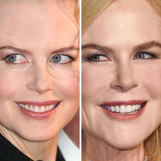 Nicole Kidman (37 i 52 godine)