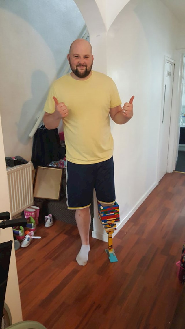 Čekao je protezu. U međuvremenu je sebi sam napravio zamjensku, i to od LEGO kockica.