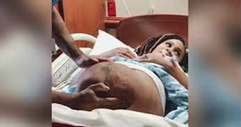 Beba se okrenula u maminom trbuhu, doktor je na pregledu učinio nešto što je mnoge zadivilo