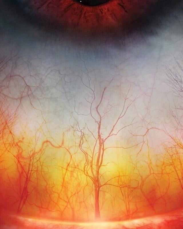 Ljudsko oko