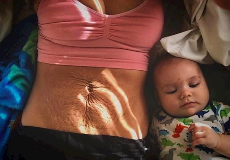 Tijelo se promijeni za vrijeme i nakon trudnoće.