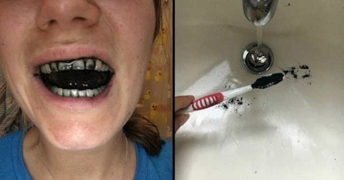 Tjedan dana je prala zube ugljenom, a onda je otkrila kako su nakon toga izgledali