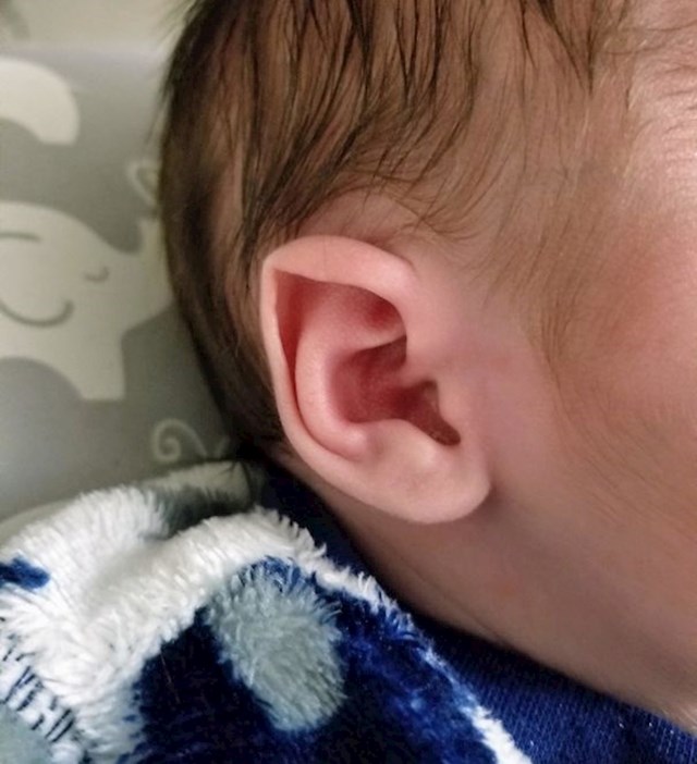 "Naš sin je rođen s prirodnim vilenjačkim ušima."