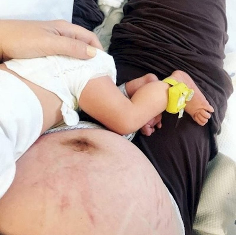 Mnoge žene se čude promjenama koje primjećuju na svome tijelu.