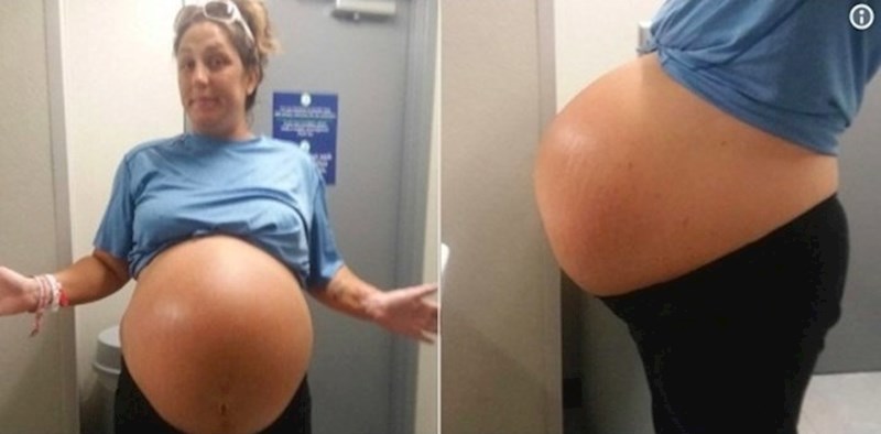 Žena s ogromnim trudničkim trbuhom rodila je bebu za koju doktori kažu da je najveća koju su ikad vidjeli