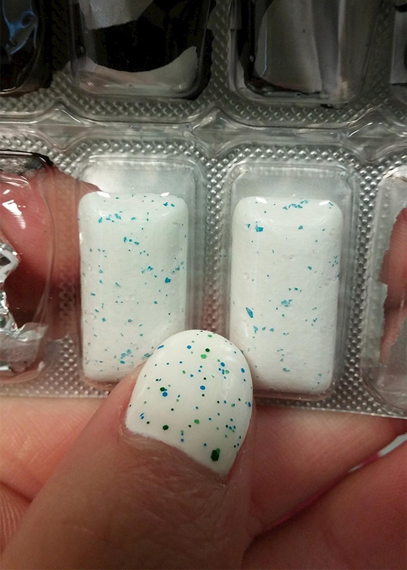 Nokti su joj izgledali kao žvake...