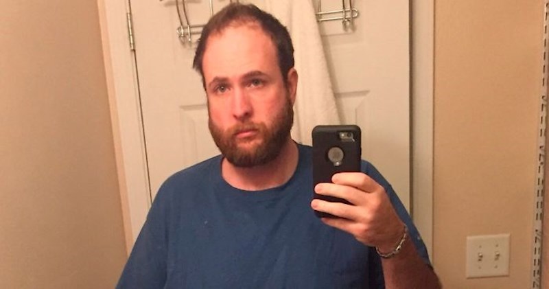 Lik koji je prestao piti alkohol redovno se slikao i pokazao koliko ga je to promijenilo