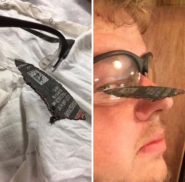 "Zaštitne naočale su zaustavile brusni disk i spasile mi oko."