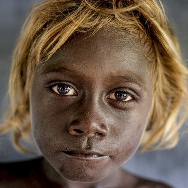 Na Salomonskim otocima postoje domoroci koji imaju tamnu kožu, ali svijetlu kosu.