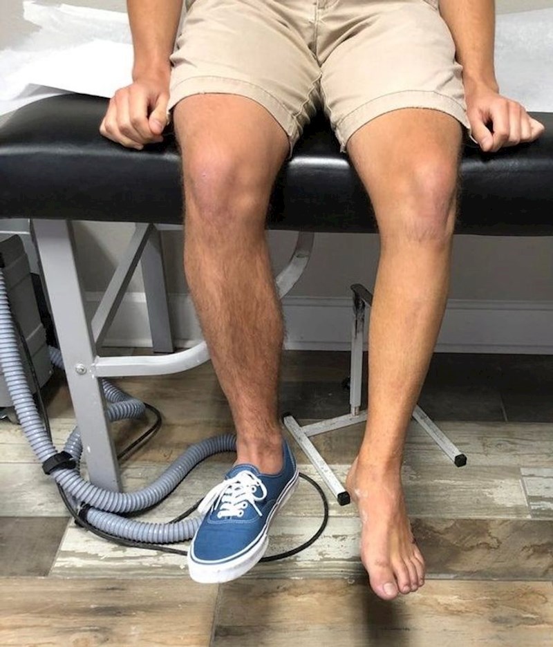 "Noga mi je mjesec dana bila u gipsu. Razlika se lako primijeti."