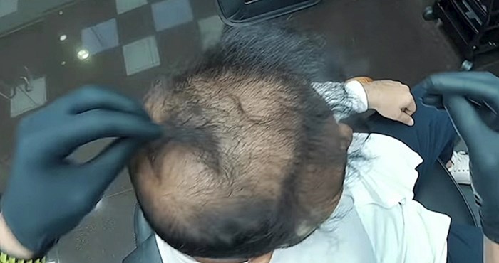 VIDEO "Najbolji frizer u Dubaiju" ponovno je začudio internet, pogledajte kako je sredio ovog proćelavog muškarca