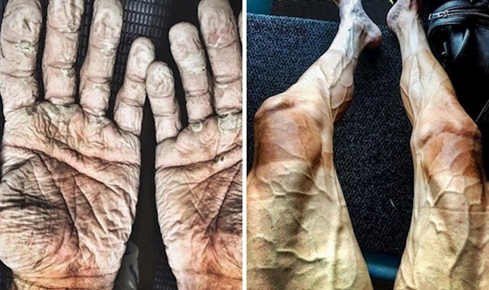 12 fotografija koje prikazuju nevjerojatnu moć ljudskog tijela i snagu volje