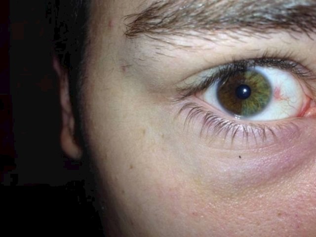 Pola oka je zeleno, a druga polovica je smeđa.