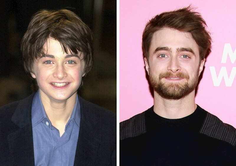 Daniel Radcliffe (2001)