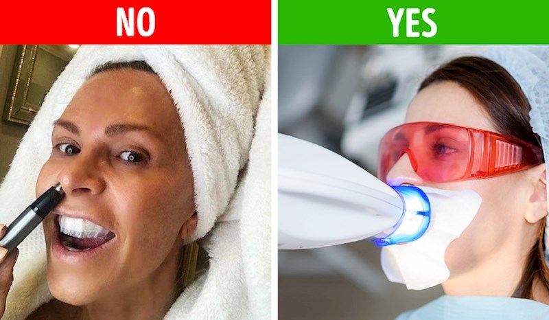 Izbjeljivanje zubiju kod kuće.