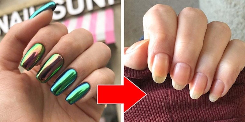 Često korištenje laka za nokte.