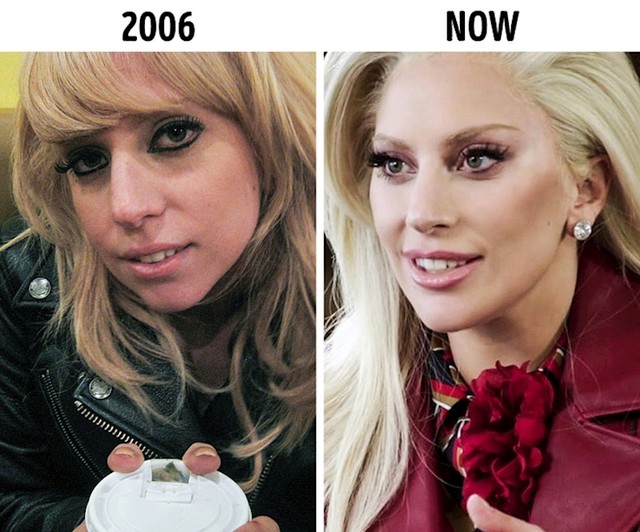 Lady Gaga