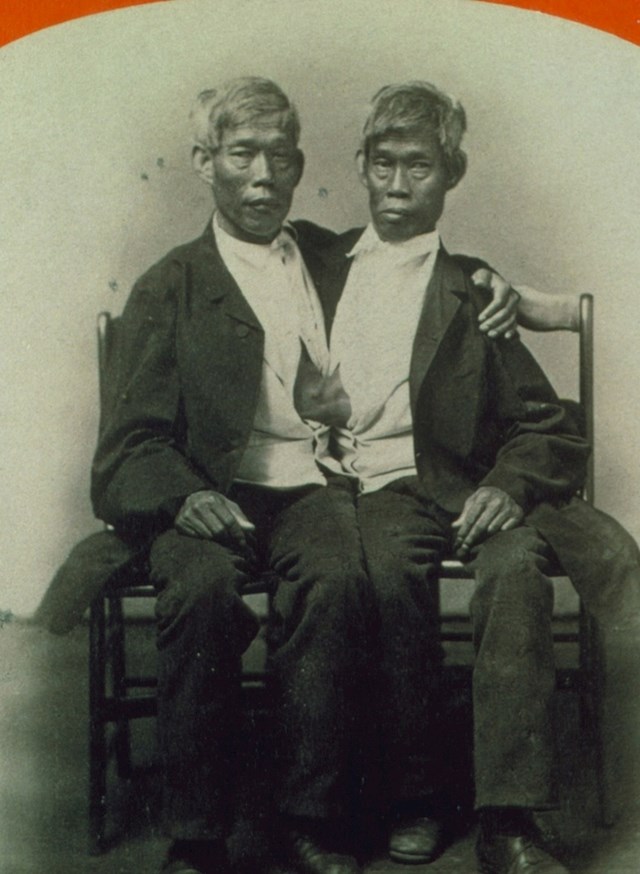 Braća Chang i Eng Bunker, zbog kojih je i nastao termin "sijamski blizanci"
