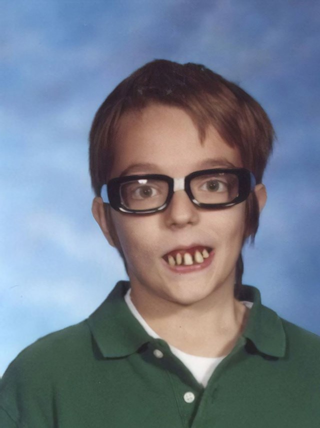 9. Umjetni zubi i fejk naočale na fotki za godišnjak - samo da naživcira mamu!