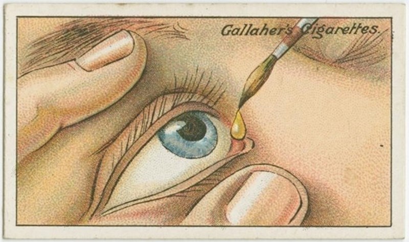 3. Kako riješiti neugodnu situaciju kad vam nešto upadne u oko