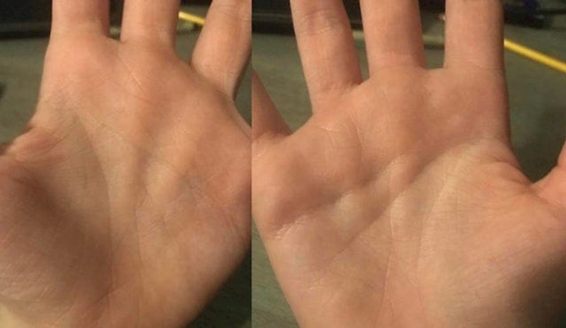 11. "Na desnoj ruci imam jedan nabor manje!"