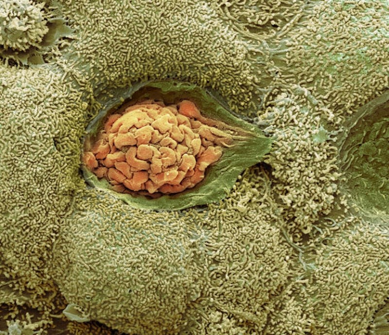 8. Izlučivanje ušnog voska