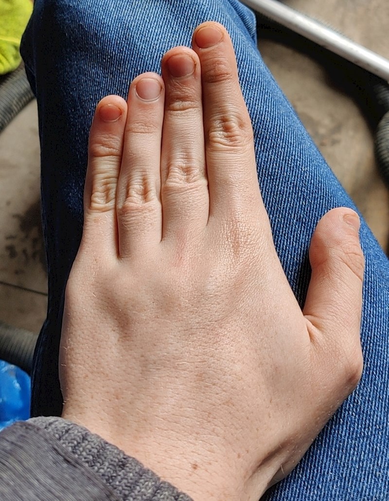 12. Nečija jedinstvena ruka